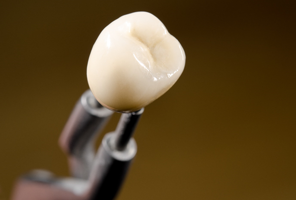 The role of dental implants can address the disruptive influences of missing teeth